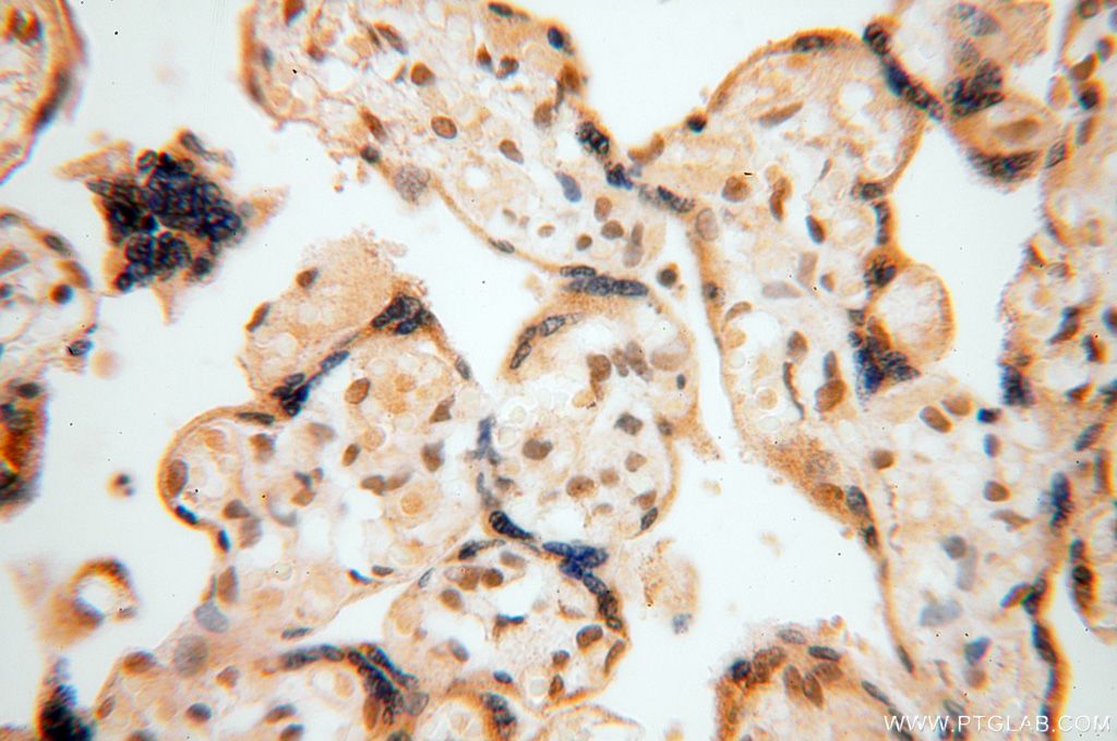 Immunohistochemistry (IHC) staining of human placenta tissue using NFKB2,p52,p100-Specific Polyclonal antibody (15503-1-AP)