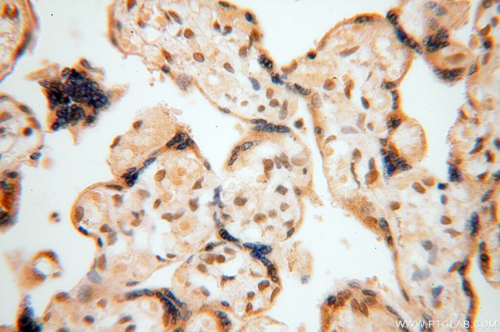 IHC staining of human placenta using 15503-1-AP