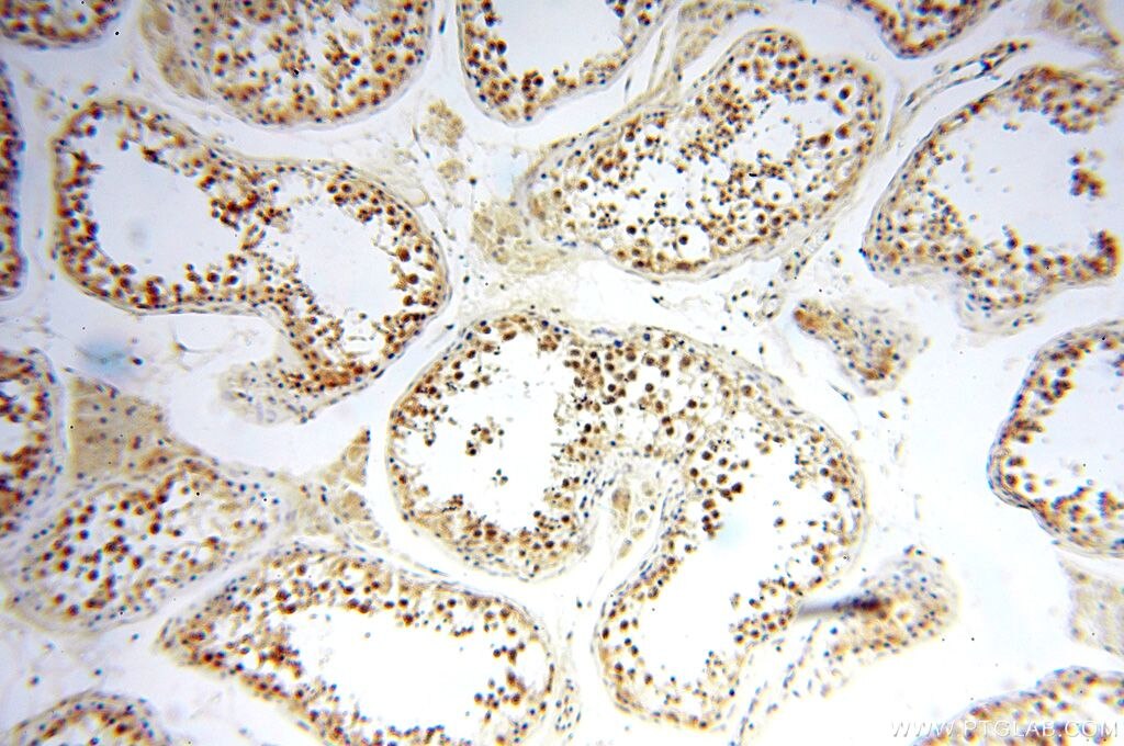 Immunohistochemistry (IHC) staining of human testis tissue using NFKB2,p52,p100-Specific Polyclonal antibody (15503-1-AP)