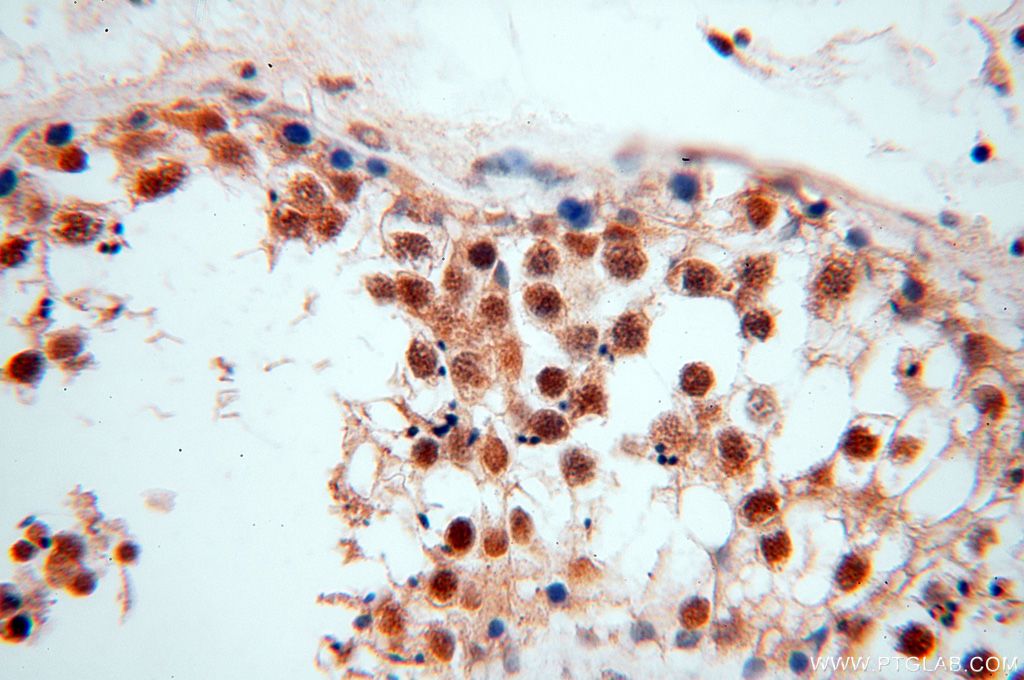 Immunohistochemistry (IHC) staining of human testis tissue using NFKB2,p52,p100-Specific Polyclonal antibody (15503-1-AP)