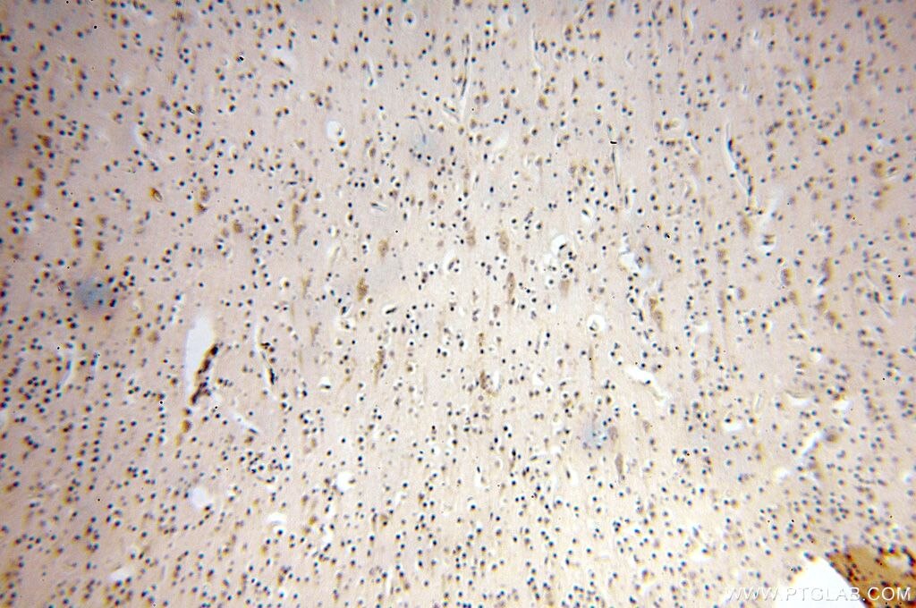 Immunohistochemistry (IHC) staining of human brain tissue using NFKB2,p52,p100-Specific Polyclonal antibody (15503-1-AP)