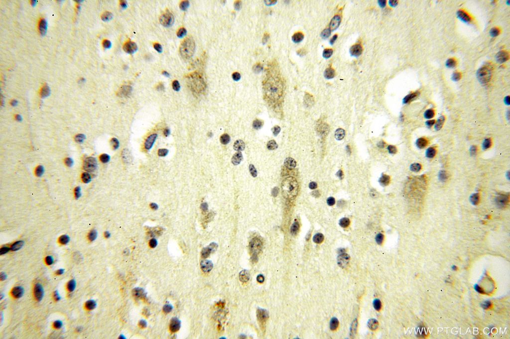 Immunohistochemistry (IHC) staining of human brain tissue using NFKB2,p52,p100-Specific Polyclonal antibody (15503-1-AP)