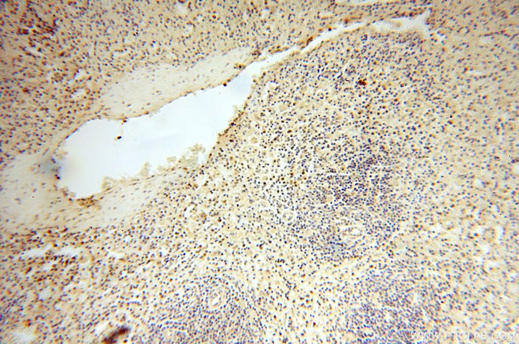 Immunohistochemistry (IHC) staining of human spleen tissue using NFKB2,p52,p100-Specific Polyclonal antibody (15503-1-AP)