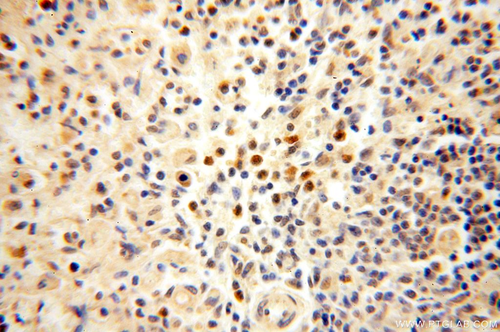 Immunohistochemistry (IHC) staining of human spleen tissue using NFKB2,p52,p100-Specific Polyclonal antibody (15503-1-AP)