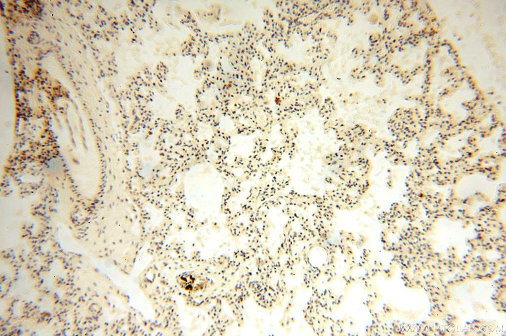 Immunohistochemistry (IHC) staining of human lung tissue using NFKB2,p52,p100-Specific Polyclonal antibody (15503-1-AP)