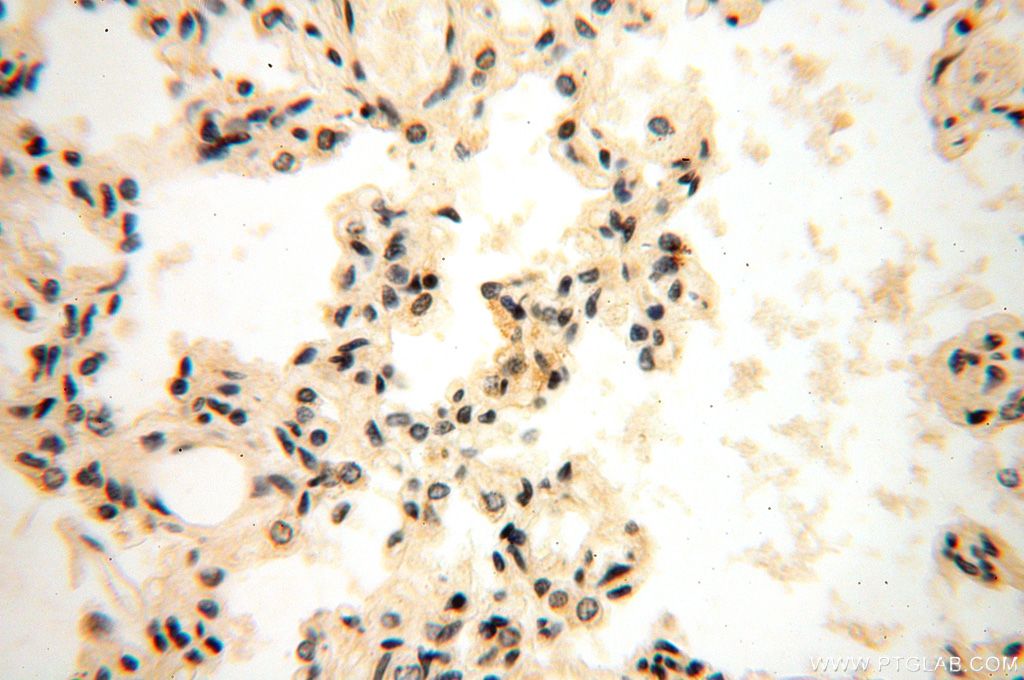 Immunohistochemistry (IHC) staining of human lung tissue using NFKB2,p52,p100-Specific Polyclonal antibody (15503-1-AP)