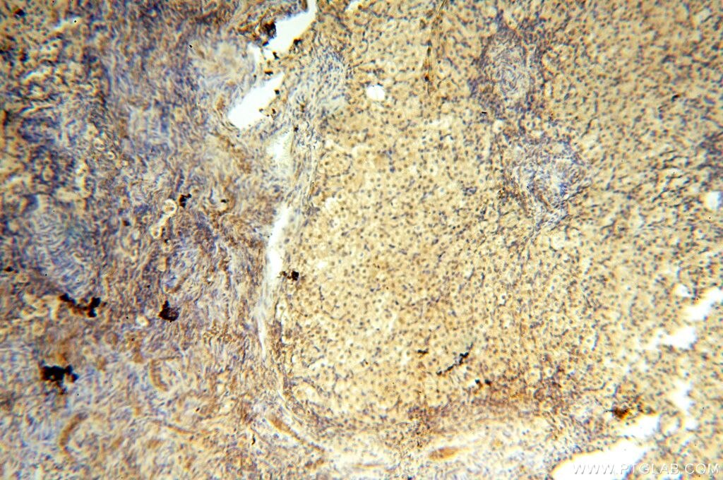 Immunohistochemistry (IHC) staining of human ovary tissue using NFKB2,p52,p100-Specific Polyclonal antibody (15503-1-AP)