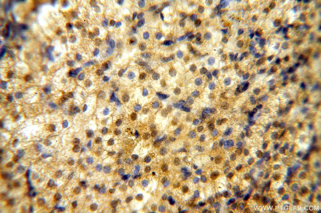 Immunohistochemistry (IHC) staining of human ovary tissue using NFKB2,p52,p100-Specific Polyclonal antibody (15503-1-AP)