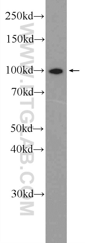 WB analysis of A431 using 15503-1-AP