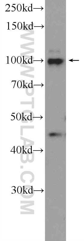 Western Blot (WB) analysis of HeLa cells using NFKB2,p52,p100-Specific Polyclonal antibody (15503-1-AP)