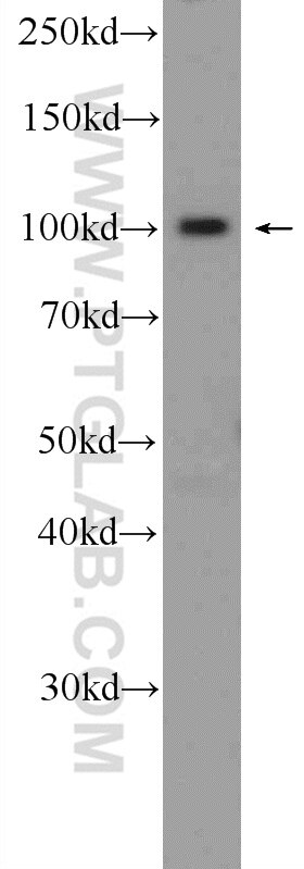 Western Blot (WB) analysis of MCF-7 cells using NFKB2,p52,p100-Specific Polyclonal antibody (15503-1-AP)