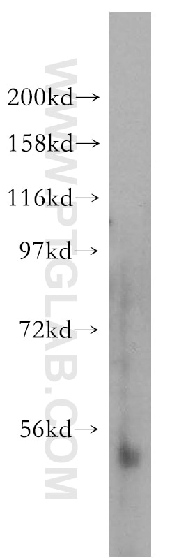 Western Blot (WB) analysis of mouse heart tissue using NFKB2,p52,p100-Specific Polyclonal antibody (15503-1-AP)