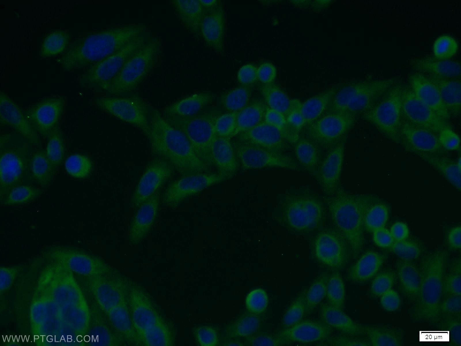 Immunofluorescence (IF) / fluorescent staining of HeLa cells using NFKB2 Polyclonal antibody (10409-2-AP)