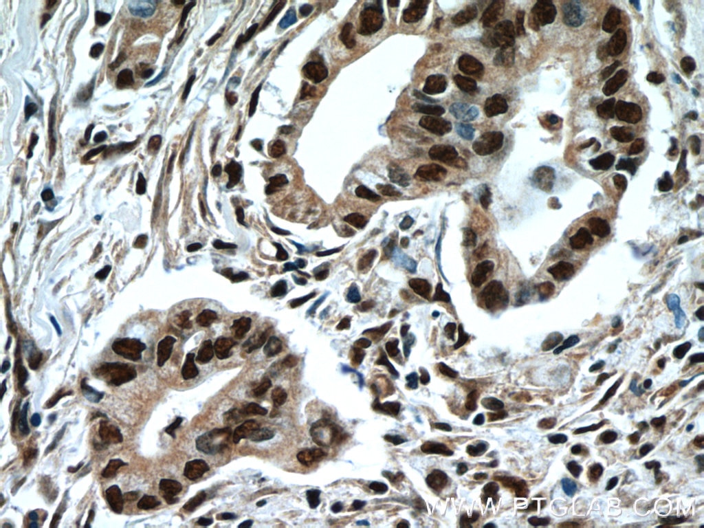 NFKB2 Polyclonal antibody