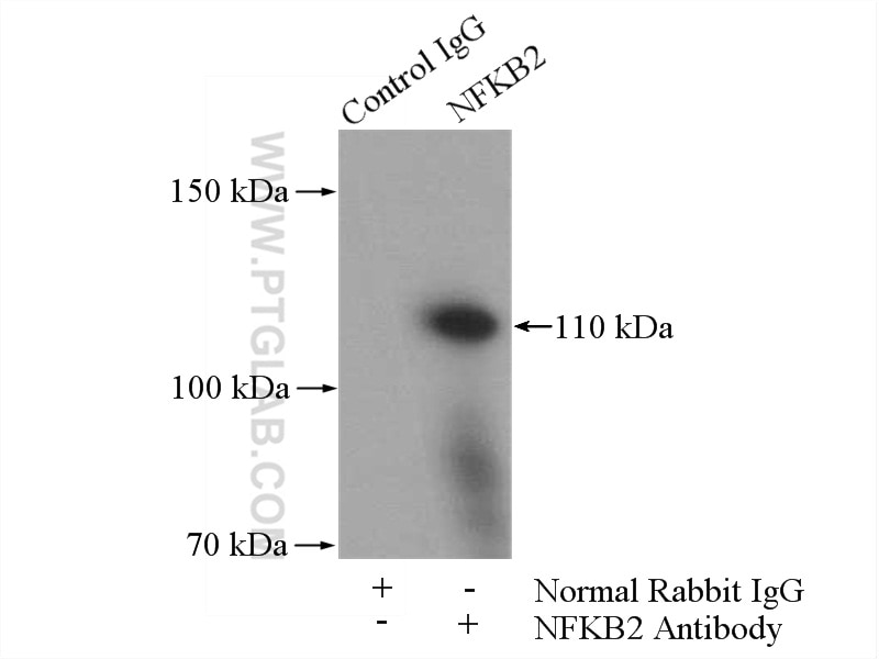 IP experiment of K-562 using 10409-2-AP