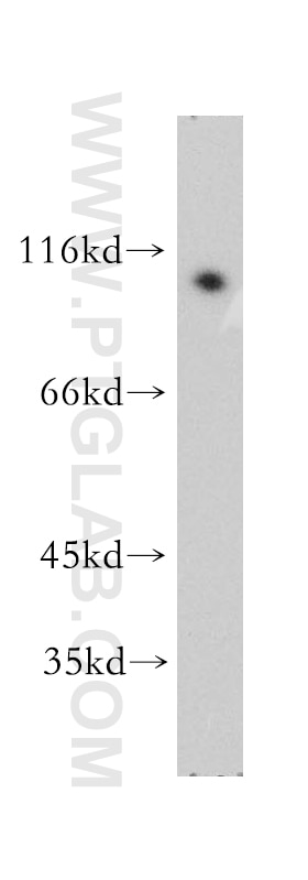 Western Blot (WB) analysis of Apoptosised HeLa cells using NFKB2 Polyclonal antibody (51085-1-AP)