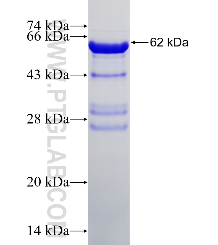 NFKB2 fusion protein Ag0662 SDS-PAGE