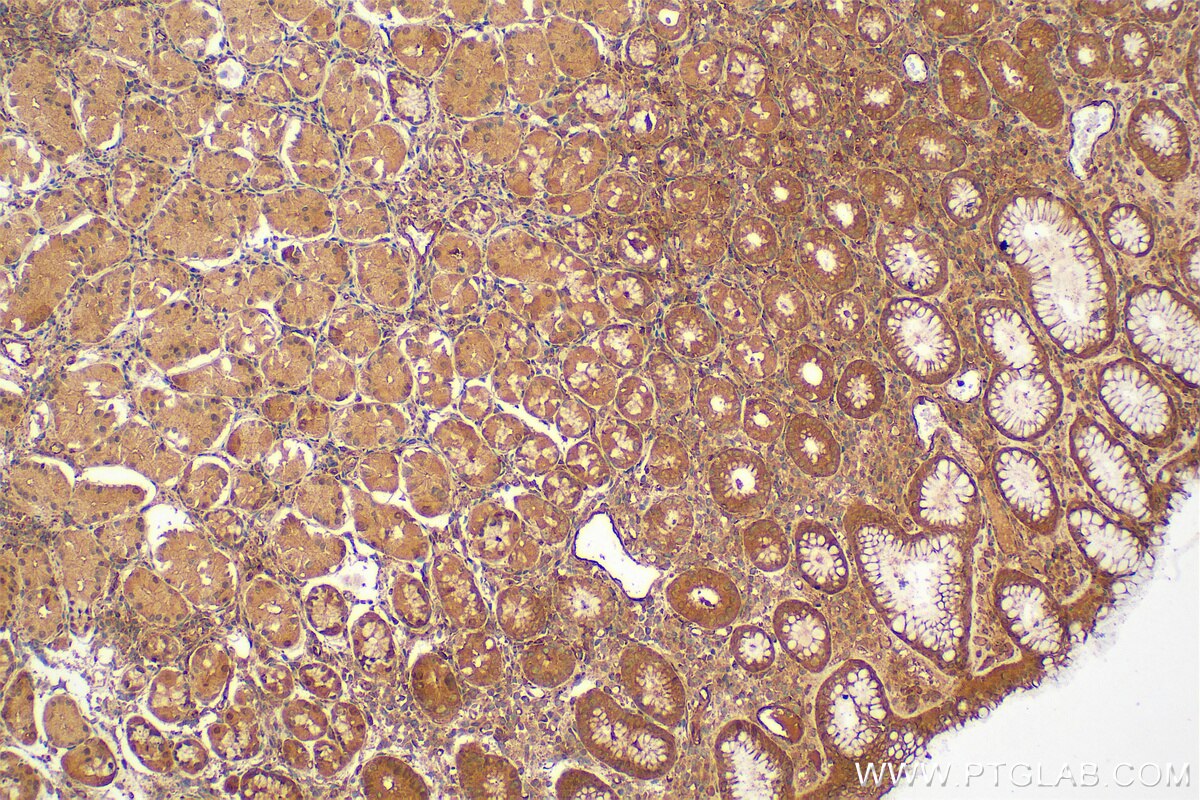 Immunohistochemistry (IHC) staining of human stomach tissue using IkB Alpha Polyclonal antibody (10268-1-AP)