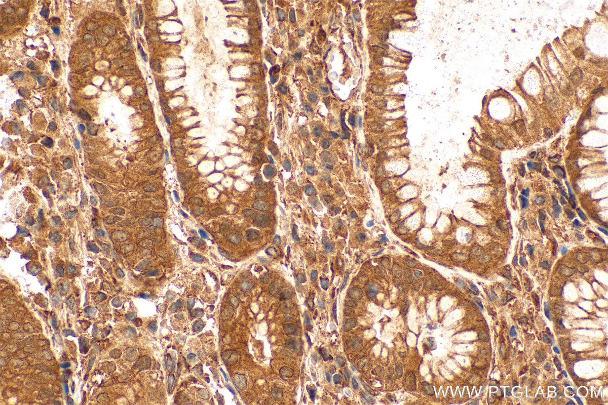 Immunohistochemistry (IHC) staining of human stomach tissue using IkB Alpha Polyclonal antibody (10268-1-AP)