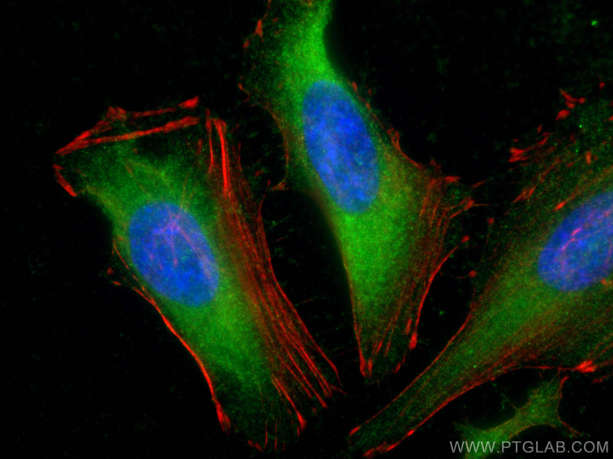 IF Staining of HeLa using 10268-1-AP