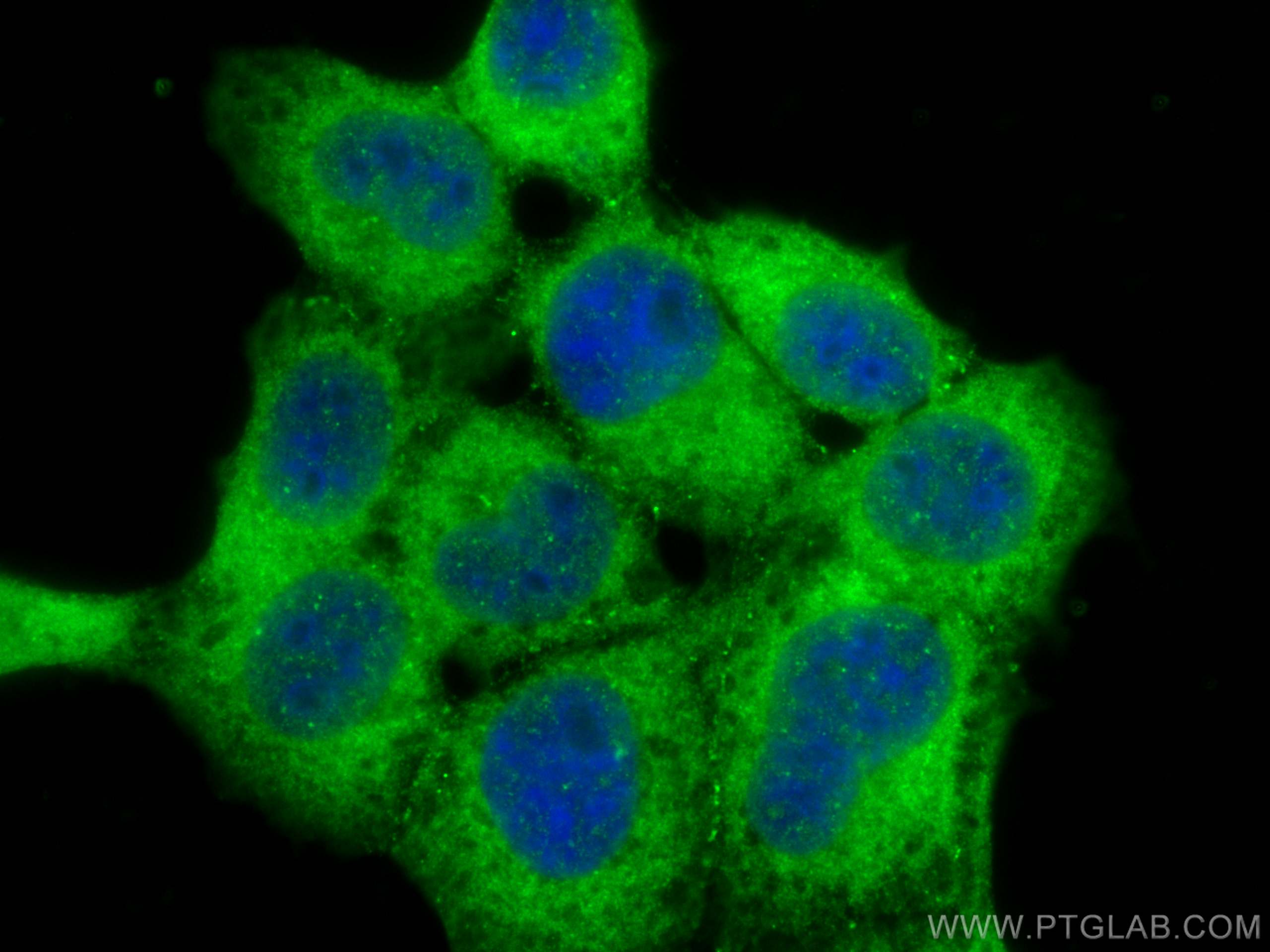 Immunofluorescence (IF) / fluorescent staining of A431 cells using IkB Alpha Polyclonal antibody (10268-1-AP)