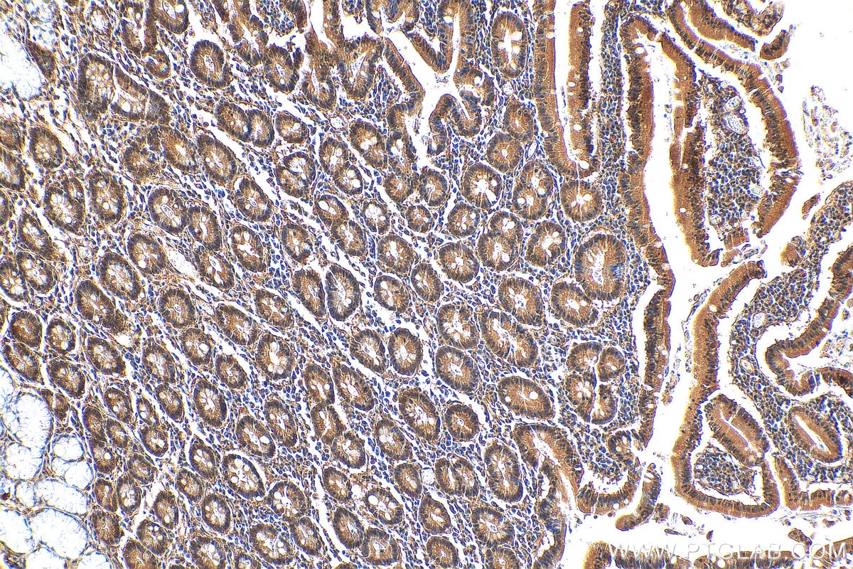 Immunohistochemistry (IHC) staining of human stomach tissue using IkB Alpha Polyclonal antibody (10268-1-AP)