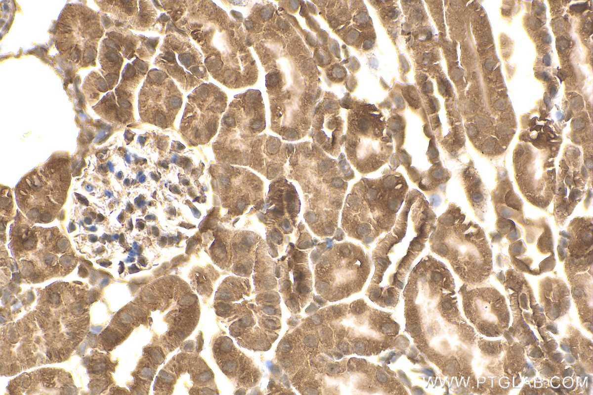 Immunohistochemistry (IHC) staining of mouse kidney tissue using IkB Alpha Polyclonal antibody (10268-1-AP)