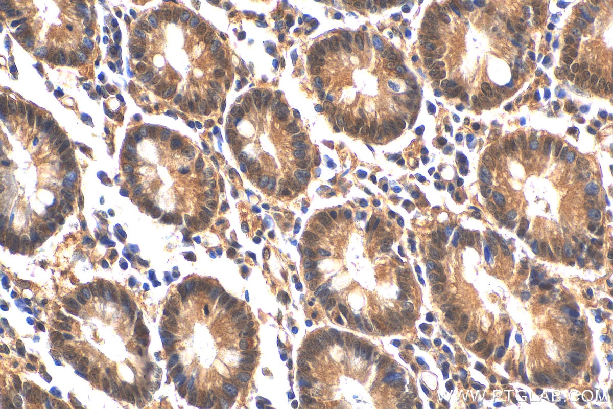 Immunohistochemistry (IHC) staining of human stomach tissue using IkB Alpha Polyclonal antibody (10268-1-AP)