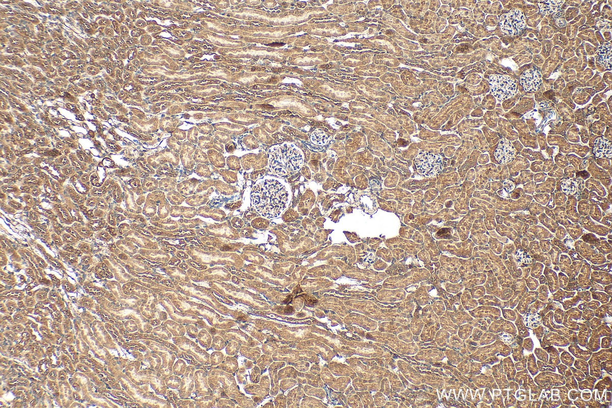 Immunohistochemistry (IHC) staining of mouse kidney tissue using IkB Alpha Polyclonal antibody (10268-1-AP)