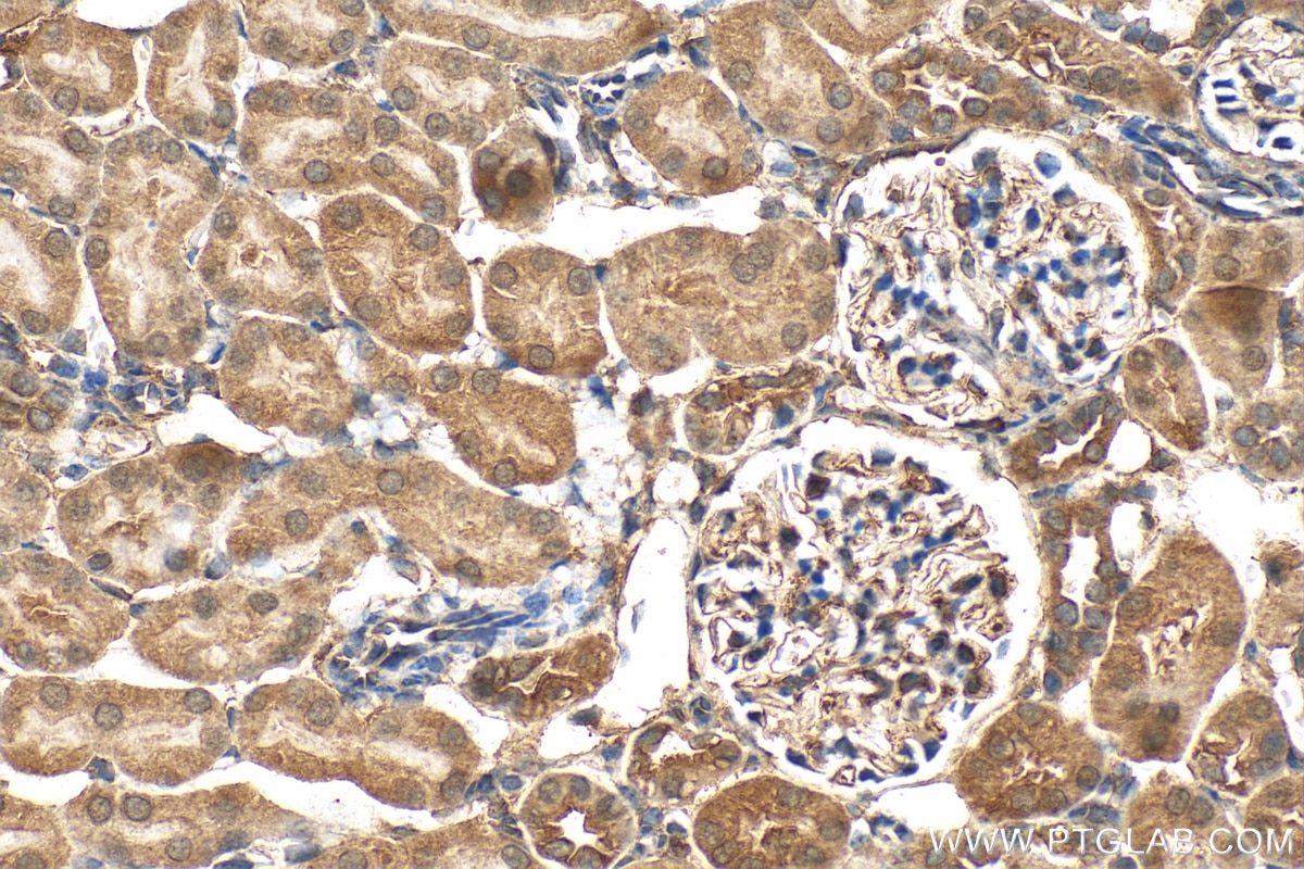 Immunohistochemistry (IHC) staining of mouse kidney tissue using IkB Alpha Polyclonal antibody (10268-1-AP)