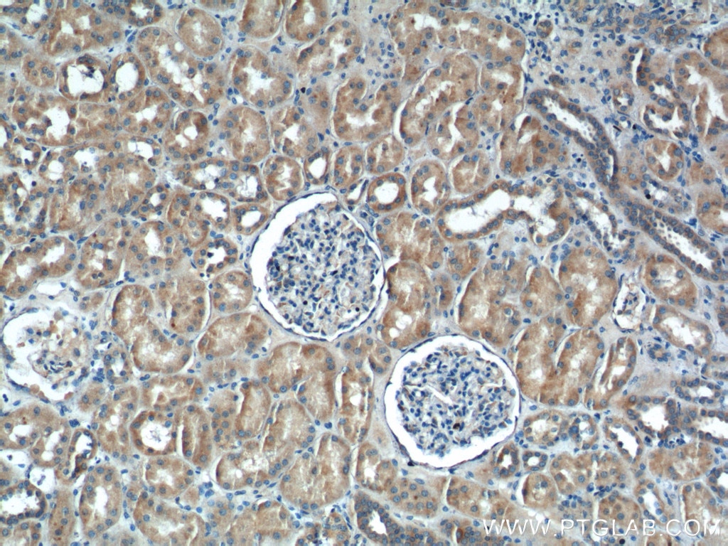 Immunohistochemistry (IHC) staining of human kidney tissue using IkB Alpha Polyclonal antibody (10268-1-AP)
