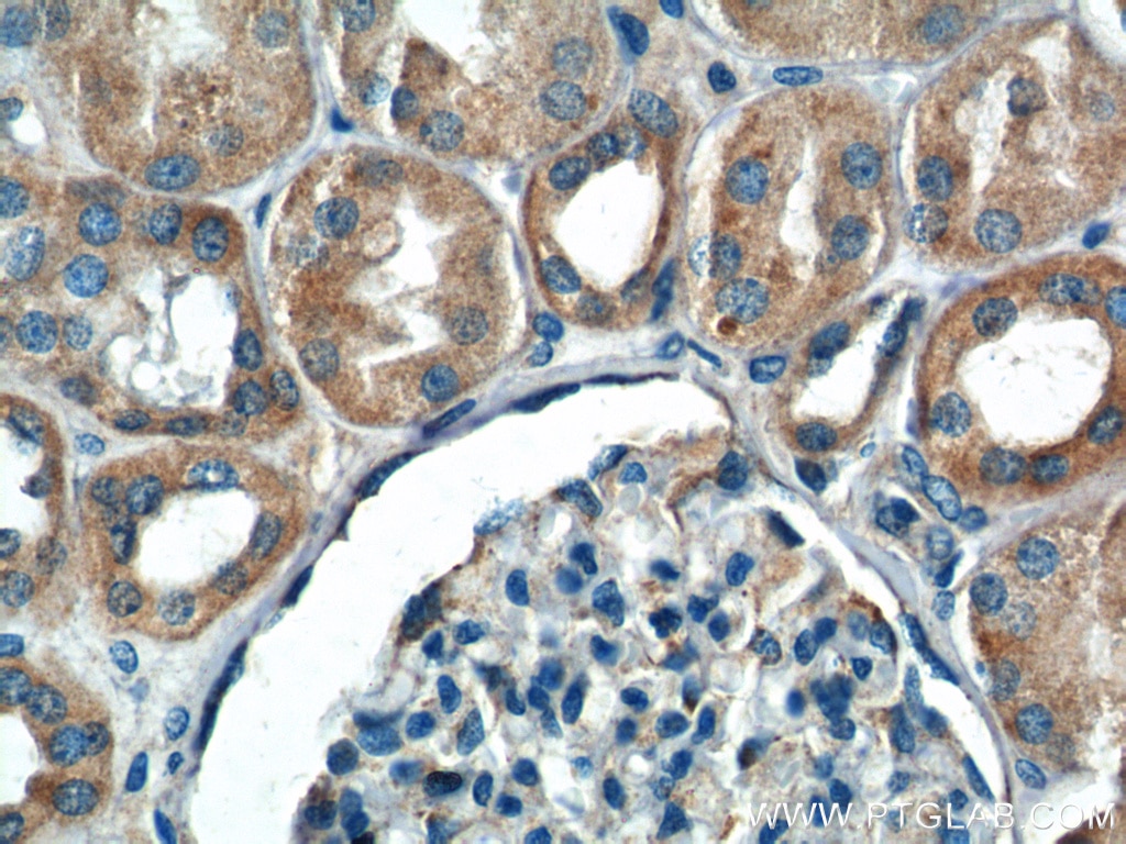 Immunohistochemistry (IHC) staining of human kidney tissue using IkB Alpha Polyclonal antibody (10268-1-AP)