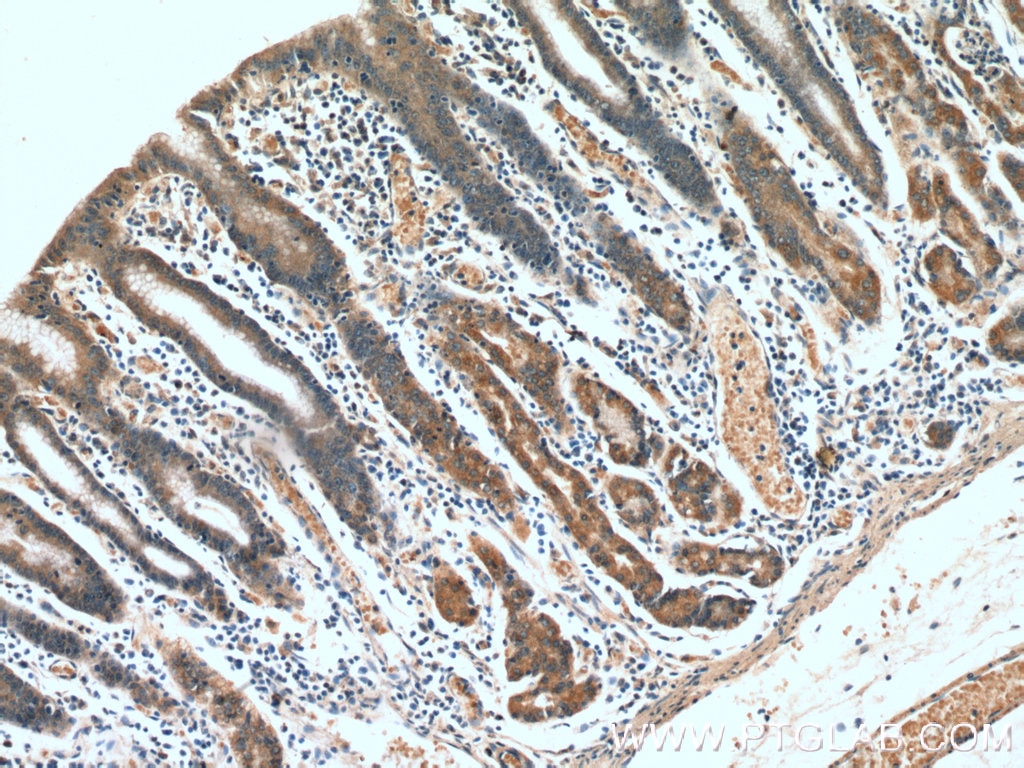 Immunohistochemistry (IHC) staining of human stomach tissue using IkB Alpha Polyclonal antibody (10268-1-AP)