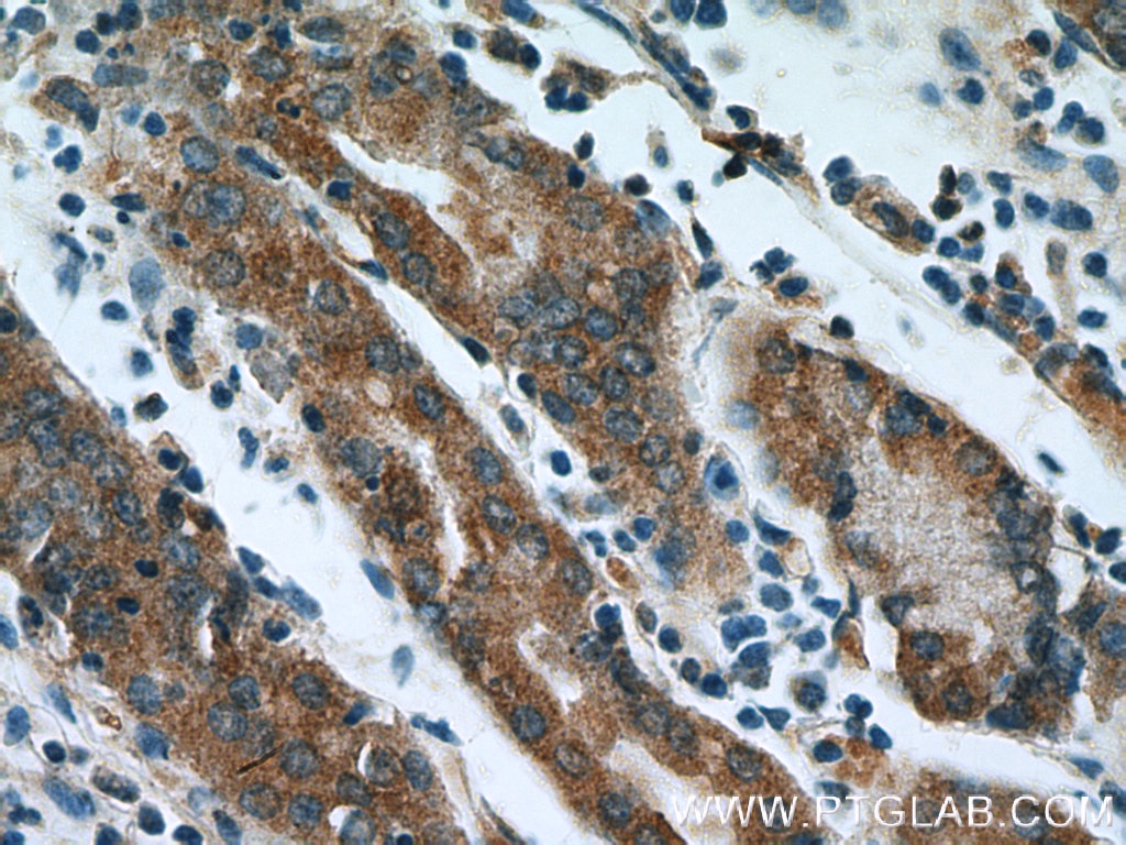 Immunohistochemistry (IHC) staining of human stomach tissue using IkB Alpha Polyclonal antibody (10268-1-AP)