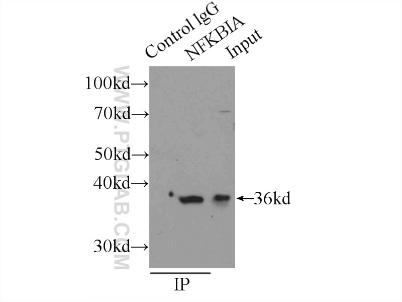 IkB Alpha Polyclonal antibody