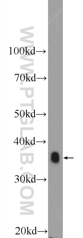 Western Blot (WB) analysis of pig liver tissue using IkB Alpha Polyclonal antibody (10268-1-AP)
