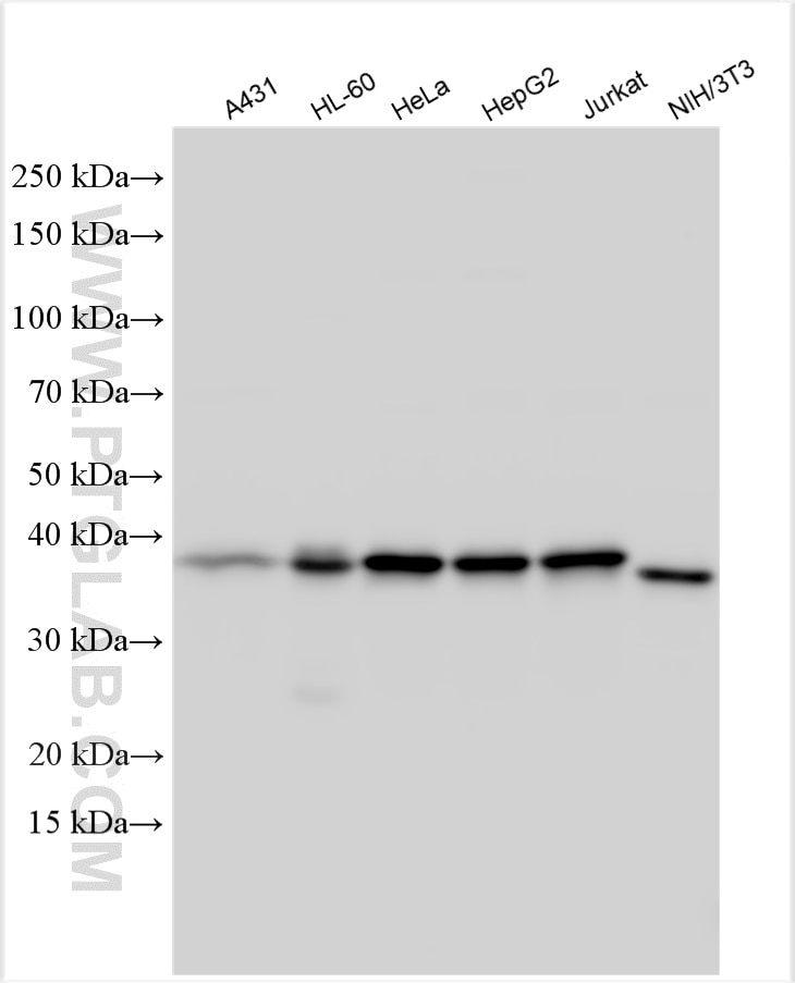 Western Blot (WB) analysis of various lysates using IkB Alpha Polyclonal antibody (10268-1-AP)