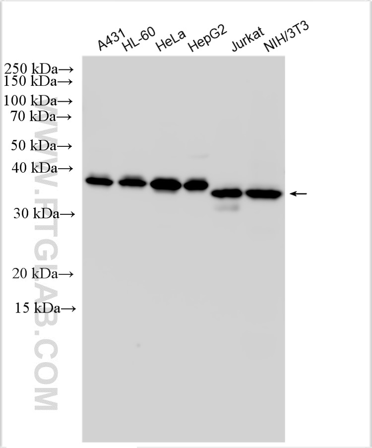 Western Blot (WB) analysis of various lysates using IkB Alpha Polyclonal antibody (10268-1-AP)