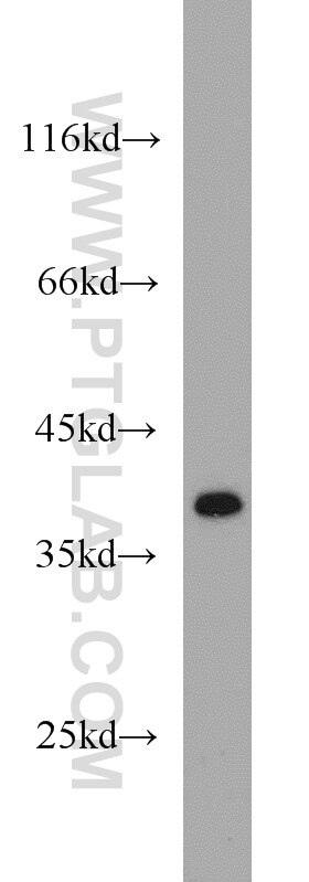 Western Blot (WB) analysis of HL-60 cells using IkB Alpha Polyclonal antibody (10268-1-AP)