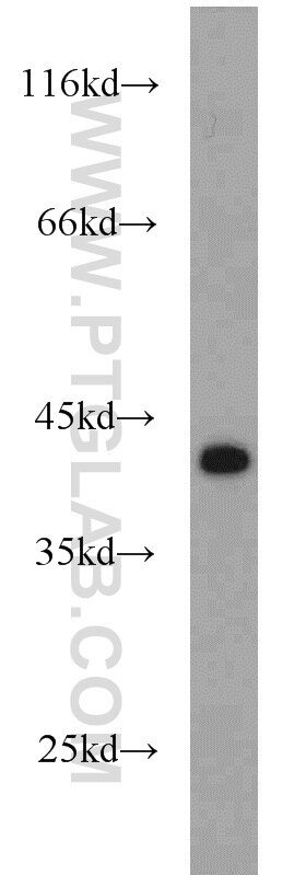 Western Blot (WB) analysis of A431 cells using IkB Alpha Polyclonal antibody (10268-1-AP)