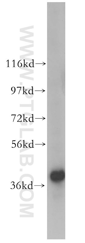 Western Blot (WB) analysis of HEK-293 cells using IkB Alpha Polyclonal antibody (10268-1-AP)