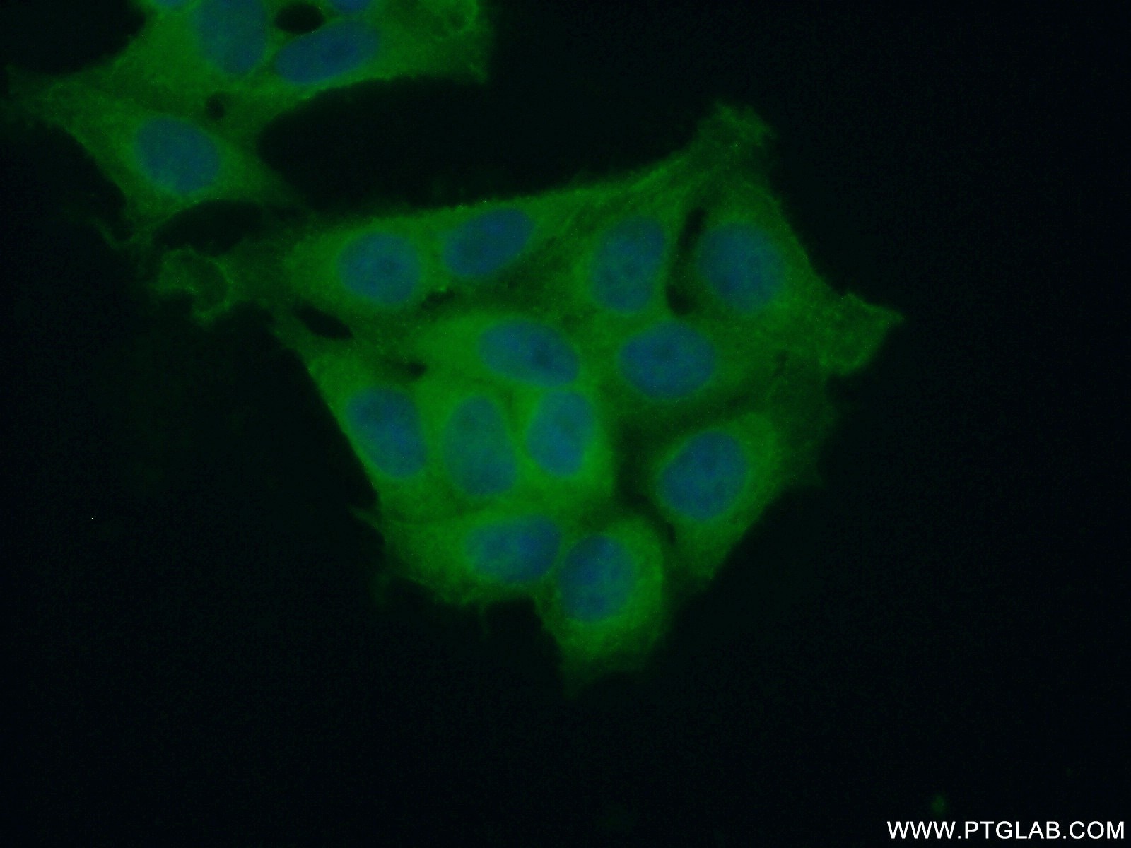 Immunofluorescence (IF) / fluorescent staining of HeLa cells using IkB Alpha Polyclonal antibody (18220-1-AP)