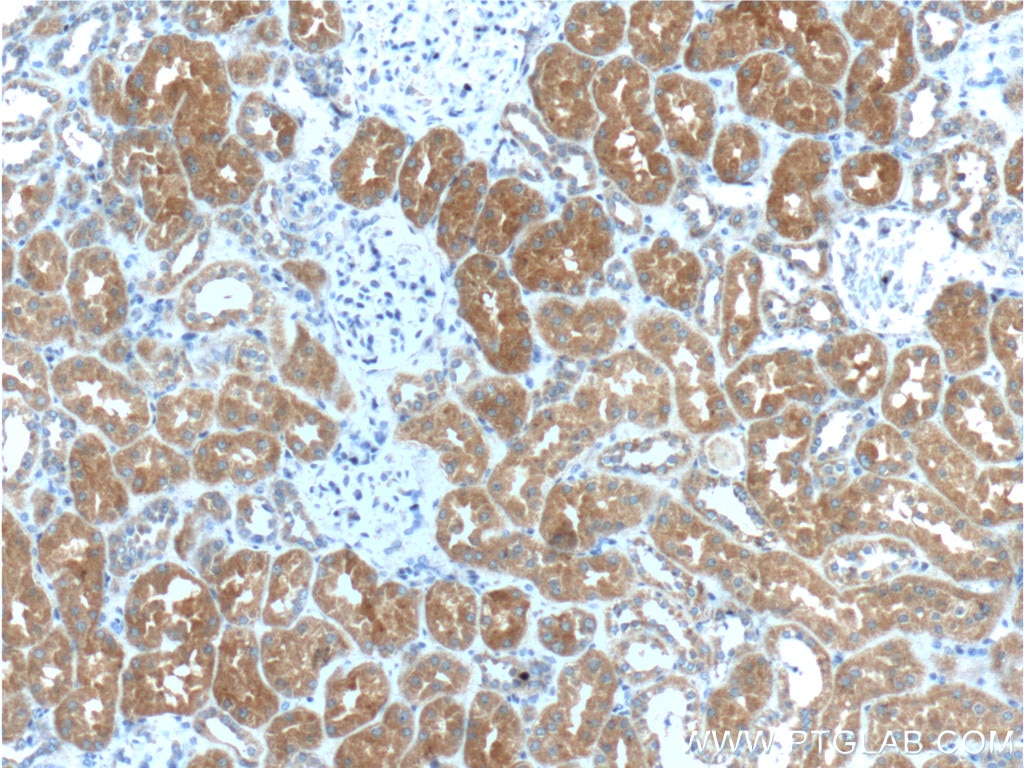 Immunohistochemistry (IHC) staining of human kidney tissue using IkB Alpha Polyclonal antibody (18220-1-AP)