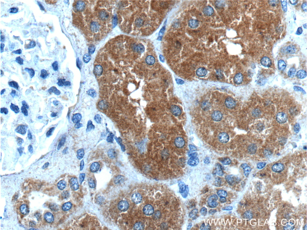 Immunohistochemistry (IHC) staining of human kidney tissue using IkB Alpha Polyclonal antibody (18220-1-AP)