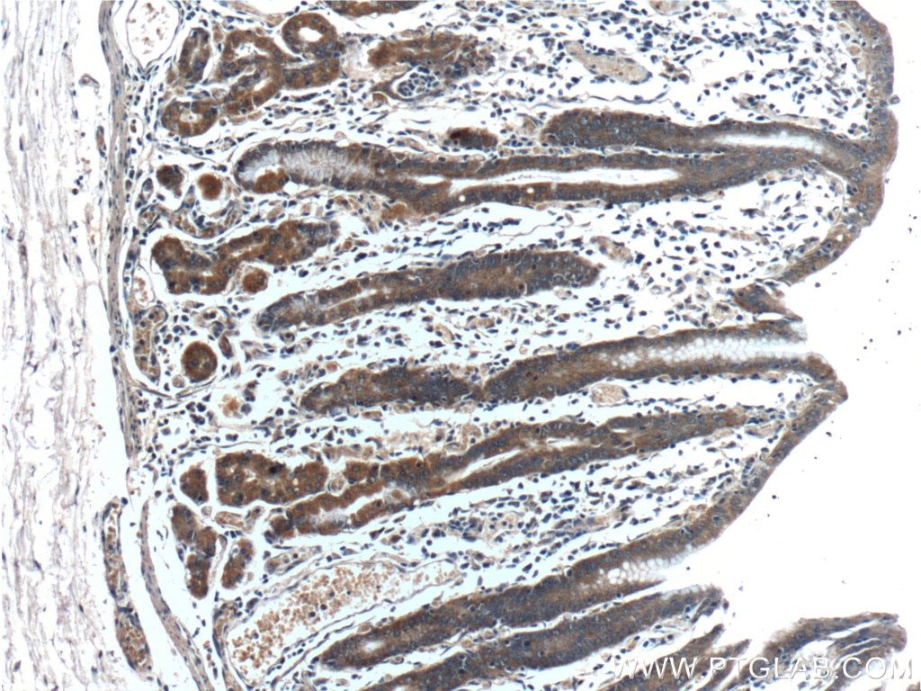 Immunohistochemistry (IHC) staining of human stomach tissue using IkB Alpha Polyclonal antibody (18220-1-AP)