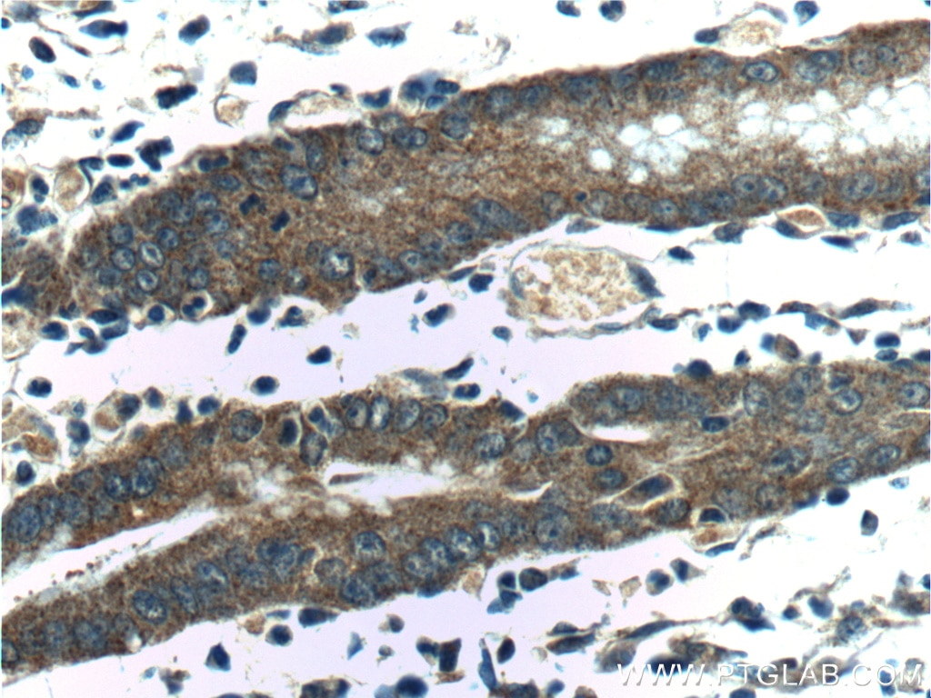 Immunohistochemistry (IHC) staining of human stomach tissue using IkB Alpha Polyclonal antibody (18220-1-AP)