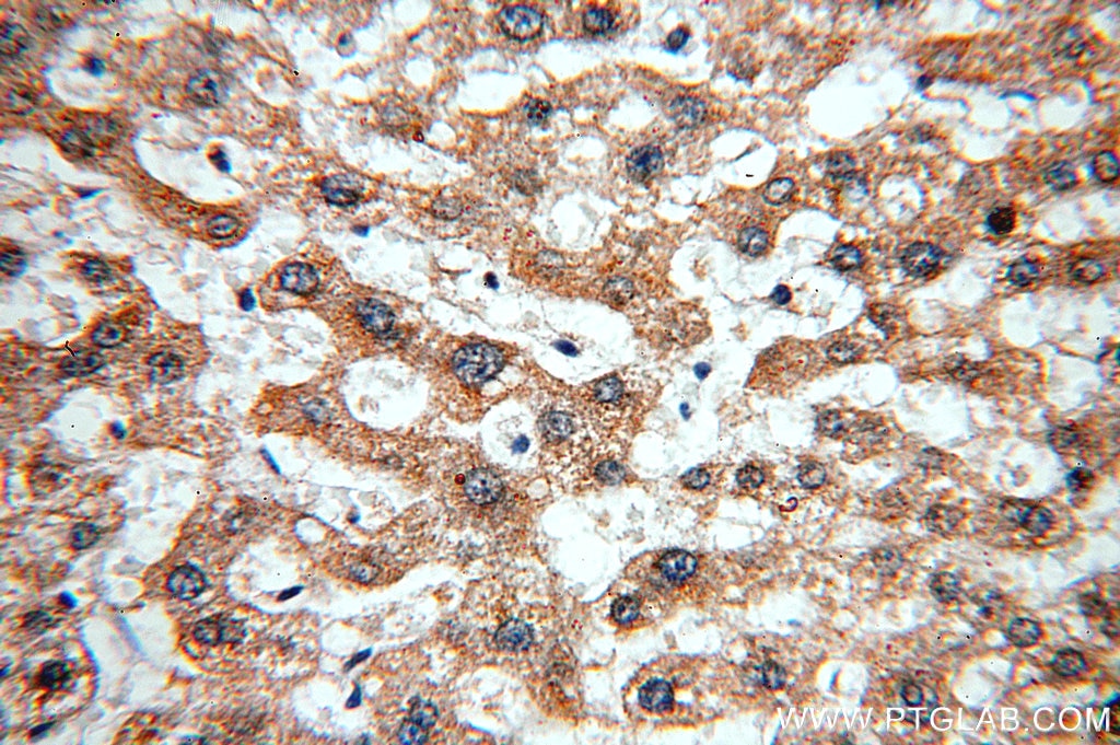 Immunohistochemistry (IHC) staining of human liver tissue using IkB Alpha Polyclonal antibody (18220-1-AP)