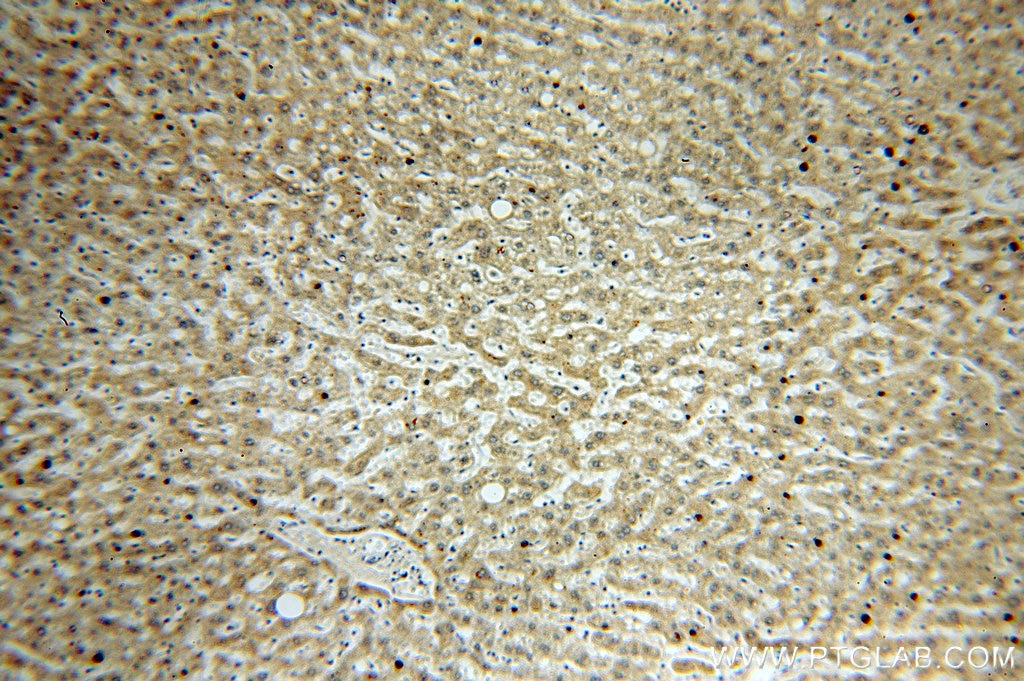 Immunohistochemistry (IHC) staining of human liver tissue using IkB Alpha Polyclonal antibody (18220-1-AP)