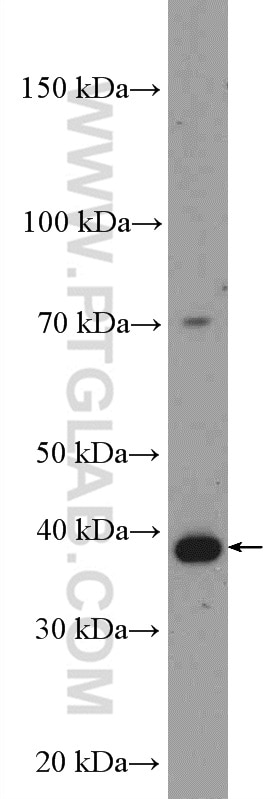 Western Blot (WB) analysis of Jurkat cells using IkB Alpha Polyclonal antibody (18220-1-AP)