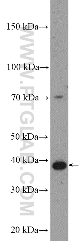 WB analysis of Jurkat using 18220-1-AP